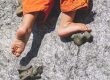 foot pain in children